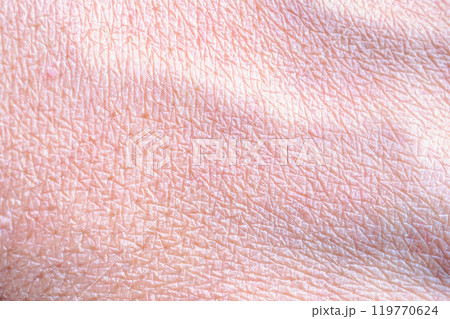 dry and dehydrated human skin texture background dry and dehydrated human skin texture background 119770624