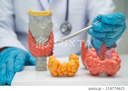 Hyperthyroidism, Overactive Thyroid, Thyroid Lymphoma, Asian doctor with thyroid gland human anatomy model in hospital. 119774625
