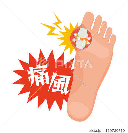 痛風発作による足の親指付け根の痛みイラスト 119780810