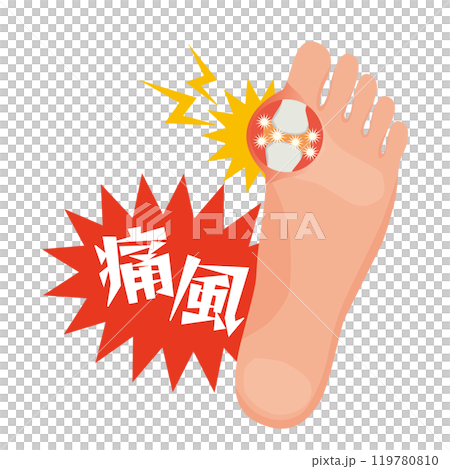 痛風発作による足の親指付け根の痛みイラスト 119780810