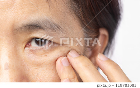 Senior asian woman worry about eye bags and dark spot. 119783083