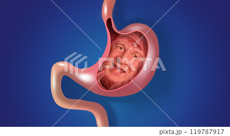 Sick stomach characters. Stomach gastritis, indigestion, vomiting, heartburn problems. Stomach pain and human face. Stomach health. Medical concept. Collage 119787917