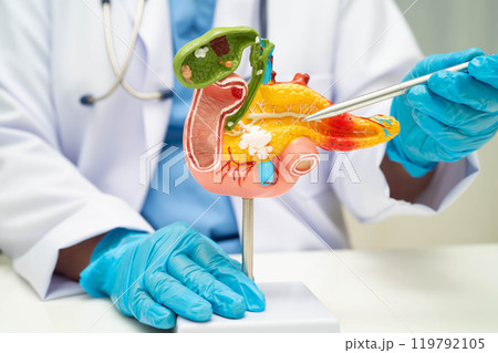 Pancreatitis, pancreatic cancer, Asian doctor with pancreas, gallbladder and bile duct human anatomy model at hospital. 119792105