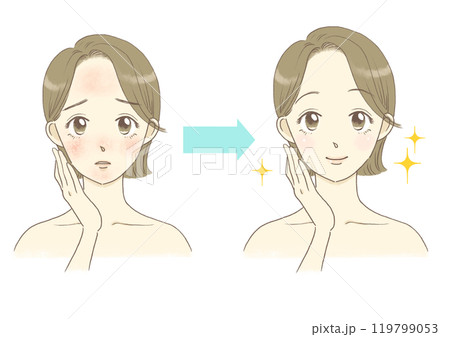 肌荒れに悩む女性のイラスト　顔の赤み　ビフォーアフター 119799053
