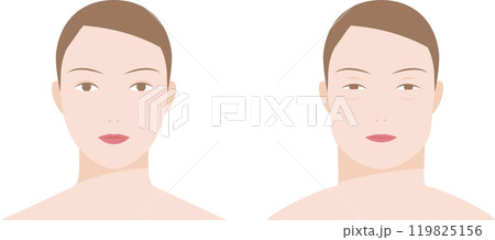 顔のむくみ、腫れがある女性の正面から見た顔のイラスト 119825156