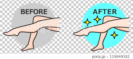 女人除毛後雙腿變得漂亮,皮膚光滑裸露 女人除毛後雙腿變得漂亮,皮膚光滑裸露 119849382