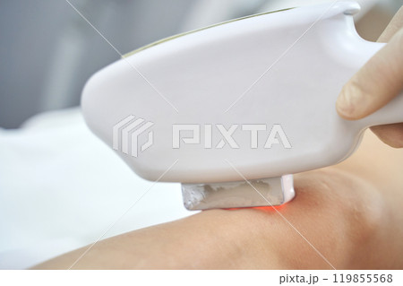 Laser hair removal procedure close up in modern beauty clinic with advanced Laser hair removal procedure close up in modern beauty clinic with advanced 119855568