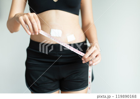 Patient women hands holding measuring tape for measure size wound after surgery on white background 119890168