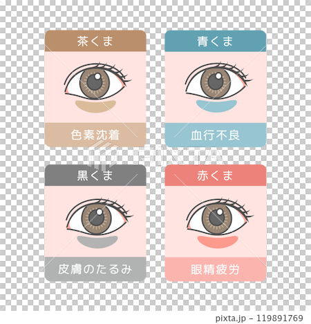 Eye bags types illustration set Eye bags types illustration set 119891769