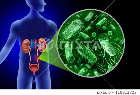Urinary Tract Infection 119912728