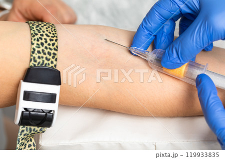Nurse taking a blood sample from a patients arm Nurse taking a blood sample from a patients arm 119933835