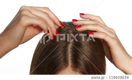 Close-up of female hands applying vitamin serum to scalp for nourishment, growth against white background. Close-up of female hands applying vitamin serum to scalp for nourishment, growth against white background. 119939039