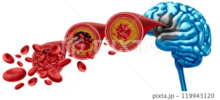 Brain Blood Flow Decline 119943120