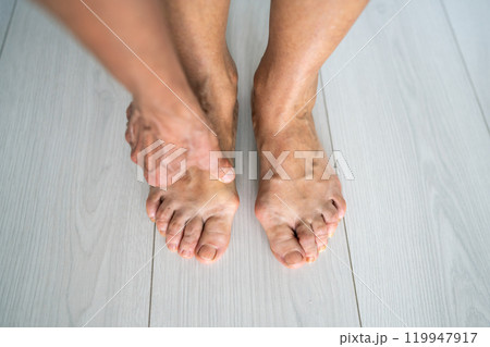Naked legs of woman suffering from painful bone on legs. Female arm hand touching aching legs. Naked legs of woman suffering from painful bone on legs. Female arm hand touching aching legs. 119947917