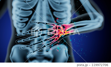 Illuminated Human Skeleton: Highlighting Elbow and Wrist Pain 119972706