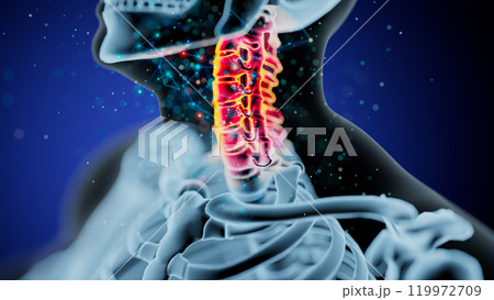 Vibrant Illustration of the Human Cervical Spine on Dark Background 119972709