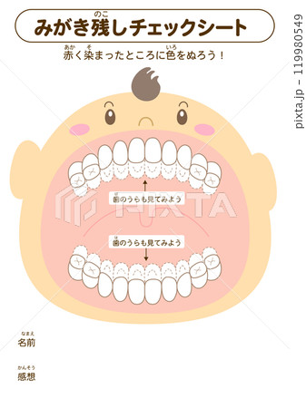 乳歯列期の磨き残しチェックシート　染め出しイラスト 119980549