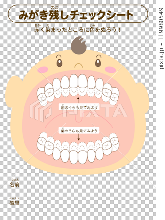 Checklist for brushing areas that are not properly cleaned during the primary dentition stage - Dye-bleached illustrations 119980549