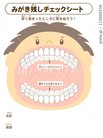 混合歯列期の磨き残しチェックシート　染め出しイラスト 119980550