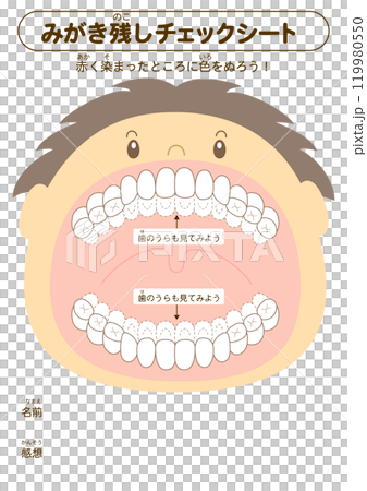 混合歯列期の磨き残しチェックシート　染め出しイラスト 119980550