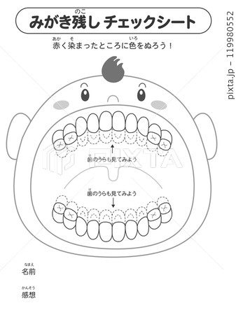 白黒 乳歯列期の磨き残しチェックシート　染め出しイラスト 119980552