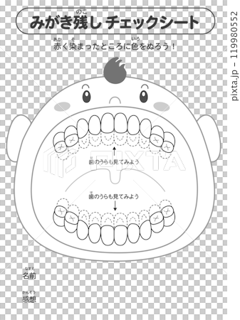 初級牙列階段未拋光牙齒的黑白檢查表 — 染色插圖 初級牙列階段未拋光牙齒的黑白檢查表 — 染色插圖 119980552