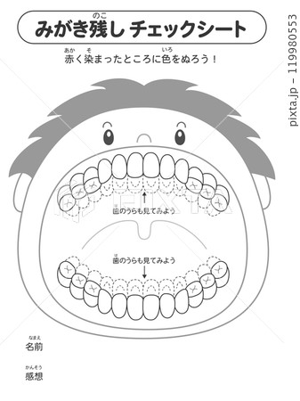 白黒 混合歯列期の磨き残しチェックシート　染め出しイラスト 119980553