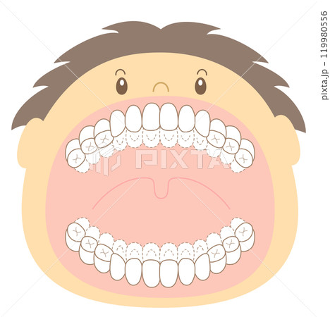 混合歯列期の磨き残しチェックシート 染め出しイラスト 混合歯列期の磨き残しチェックシート 染め出しイラスト 119980556
