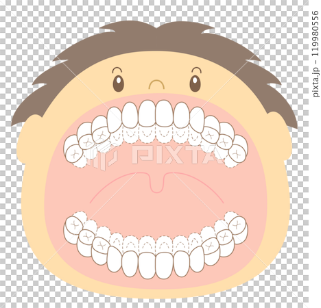 Mixed dentition stage checklist for areas not brushed properly - dyed illustrations 119980556