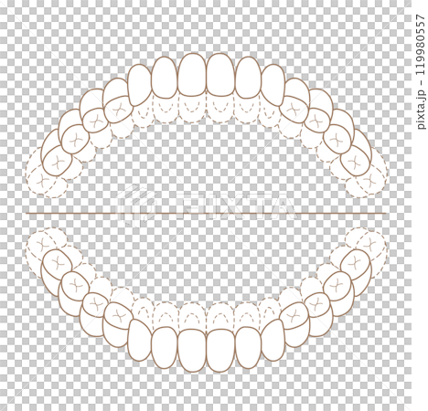 恆牙列期未拋光檢查表-染色插圖 恆牙列期未拋光檢查表-染色插圖 119980557