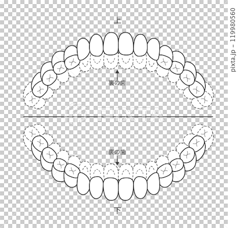 恆牙列階段未拋光部份的黑白檢查表 — 染色插圖 恆牙列階段未拋光部份的黑白檢查表 — 染色插圖 119980560