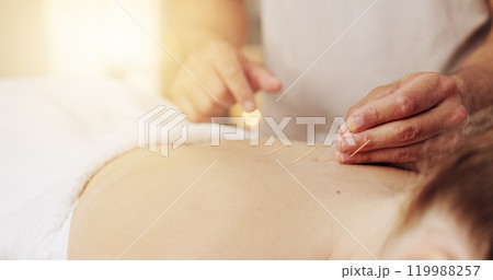 Acupuncture, hands and stress relief in spa with customer for healing, holistic therapy or to relax. Body, dry needling and treatment with masseuse in resort for cosmetics, massage and skincare Acupuncture, hands and stress relief in spa with customer for healing, holistic therapy or to relax. Body, dry needling and treatment with masseuse in resort for cosmetics, massage and skincare 119988257