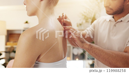 Acupuncture, back and treatment in spa with customer for holistic healing, stress relief or therapy. Body, hands and relax with professional masseuse in resort for cosmetics, massage and skincare Acupuncture, back and treatment in spa with customer for holistic healing, stress relief or therapy. Body, hands and relax with professional masseuse in resort for cosmetics, massage and skincare 119988258