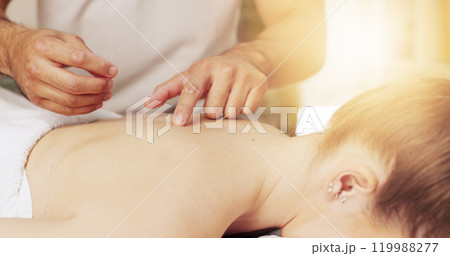 Acupuncture, back and hands in spa with customer treatment for healing, stress relief or therapy. Body, dry needling and holistic with masseuse in resort for cosmetics, massage and natural skincare 119988277