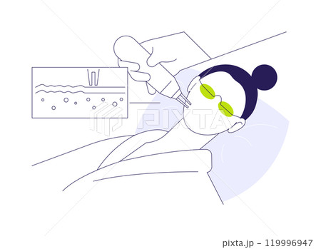 Laser peels abstract concept vector illustration. 119996947
