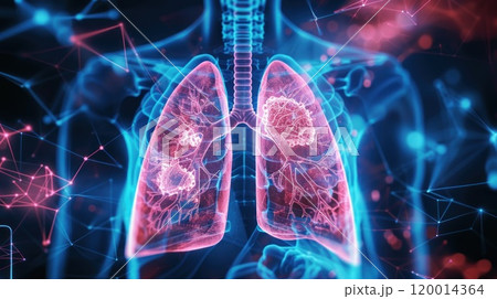 A blue and orange lung is shown in a computer generated image 120014364