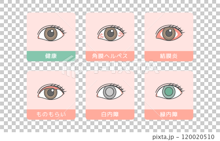 目の病気　イラストセット 120020510