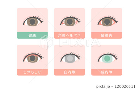 目の病気　イラストセット 120020511