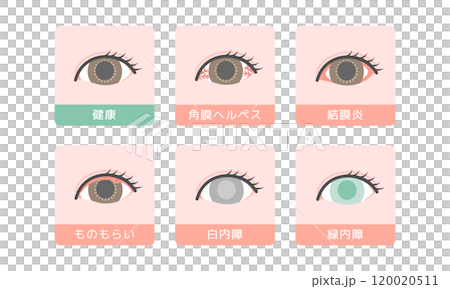 Eye disease illustration set Eye disease illustration set 120020511