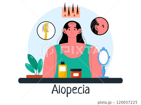 Alopecia Vector Illustration featuring Hair Loss due to Autoimmune Disease and Baldness in a Healthcare Theme with a Flat Style Cartoon Background 120037225