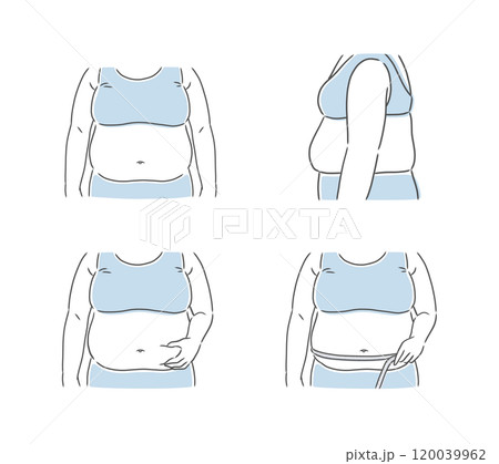 お腹の大きな肥満女性のイラスト素材 お腹の大きな肥満女性のイラスト素材 120039962