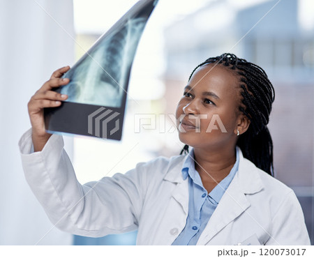 Shes noticed something...Shot of a young doctor analysing an x-ray in a hospital. Shes noticed something...Shot of a young doctor analysing an x-ray in a hospital. 120073017