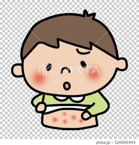 Boy with eczema on his body Boy with eczema on his body 120095943