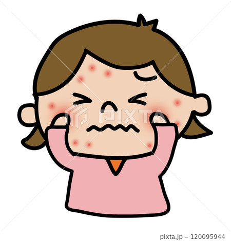 顔に湿疹ができて痒がる女の子 120095944