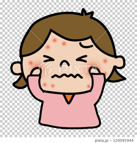 顔に湿疹ができて痒がる女の子 120095944