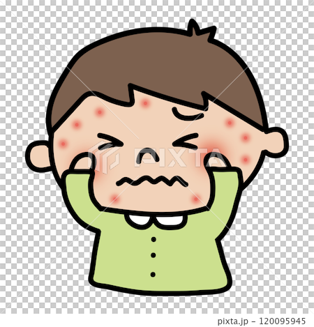 男孩臉上長濕疹很癢 120095945