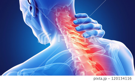 首痛の視覚表現: ルンバー領域での痛みと不快感を具現化したイメージ. 120134116