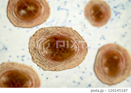 Ascaris lumbricoides unfertilized egg, illustration 120145187