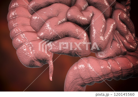 Human colon with appendix Human colon with appendix 120145560