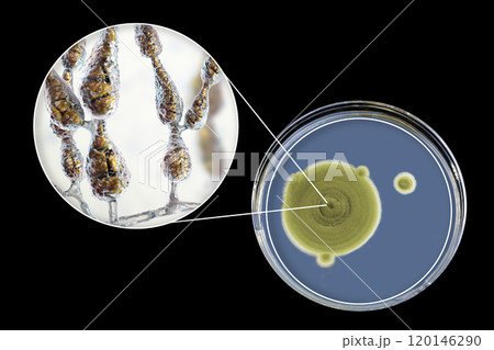 Mold Alternaria alternata, illustration and photo of colony on nutrient medium 120146290